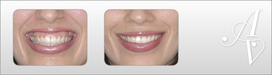 Cosmetic treatment Knightsbridge
